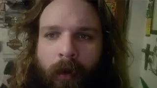 Update vlog: Fifty-Fifth after stopping Minoxidil for beard growth (read description below)