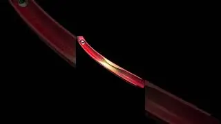 Not all the blocks in a heart need Stent | Dr Aravind