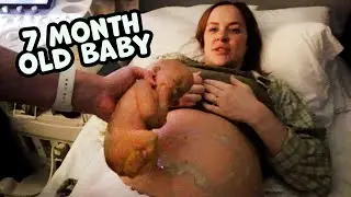 Emotional 4D Ultrasound...Getting to see our baby for the first time!
