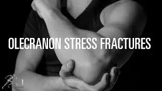 Olecranon stress fracture: Treatment and prevention of this pitching injury