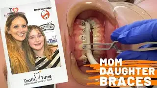 Braces in New Braunfels: Mom and Daughter get Braces at ToothTime Family Dentistry