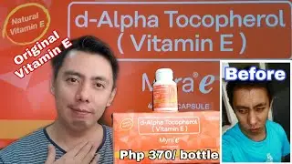 HONEST REVIEW OF ORIGINAL MYRA E 400 IU D-ALPHA TOCOPHEROL (VITAMIN E) CAPSULE | REAL TALK