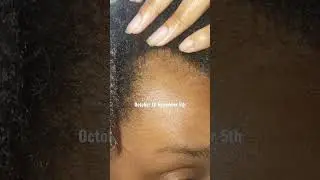 I shaved my edges so you wouldn't have to (Growing Back My Edges Timeline)