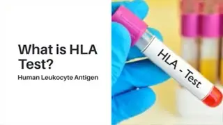 What is a HLA Tissue Typing Test? Human Leukocyte Antigen | Lyfboat
