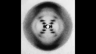Rosalind Franklin: The Genius Behind DNA's Discovery | Photograph 51 & The Blueprint of Life