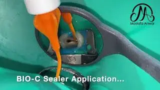 BIO-C Sealer Application in Confluent Root Canals | How to Apply BioCeramic Sealer for Obturation?