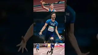 How I Lost My Legs