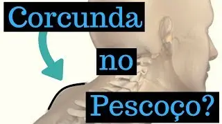 Corcunda no Pescoço? Tem relação com Peso?