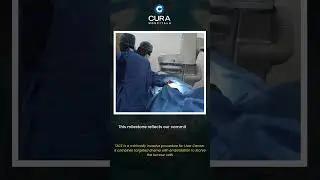 Medical Milestone | Rare TACE Procedure Successfully Performed at Cura Hospitals