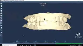 DentalCad 6.2 - Model Maker