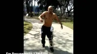 Recuperação da perna após cirurgia em 17/07/14