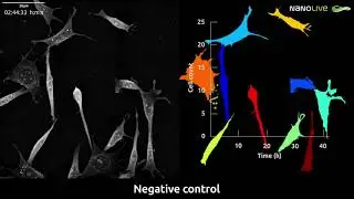 Kinase perturbation - pre-adipocytes control (Nanolive's CX-A, segmentation, quantification)