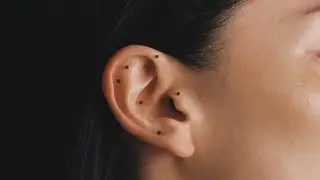 AURICULAR MEDICINE Quiz 2