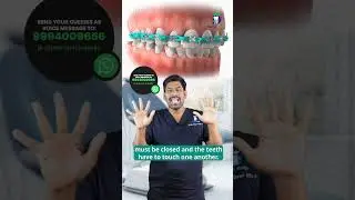 கிளிப்பை கழட்டும் முன் இதை பாருங்கள்!!! -How to Check Braces Completion |Dr.Karthikeyan |Denta Kings