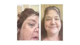 Grateful Patient Series: Colleen Johnson, Dr. Toman & Dr. Tabor
