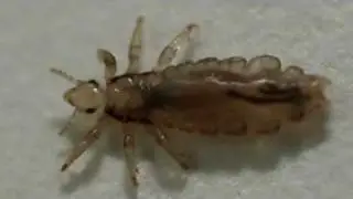Is It Head Lice?