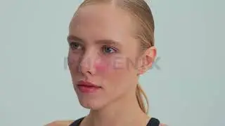 Elevate Your Beauty with Cheek Augmentation | Phoenix Health Tourism Istanbul