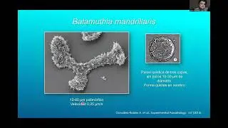 Avances en Investigación en Amebas de Vida Libre
