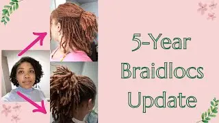 5 year Braidlocs Update!