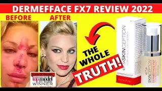 Dermefface FX7 Review - Scar Removal Cream [2022 Updated] - The Dermefface FX7 Work?