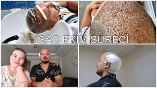 EŞİME SAÇ EKTİRDİK | AMELİYAT SÜRECİ | FİYAT NE KADAR? | ACILI BİR İŞLEM Mİ? | Saç ekimi