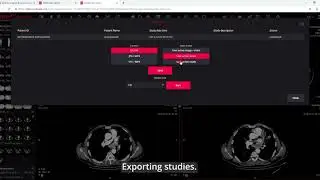 MedDream DICOM Viewer: export the studies