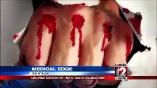 Medical Edge: Study on Intermittent Explosive Disorder