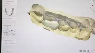 Dentisterie digitale