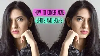 How to Cover Acne Scars and Spots in less than 5 Minutes