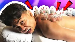 GUAVA JUICE TRIES CUPPING FOR THE FIRST TIME!