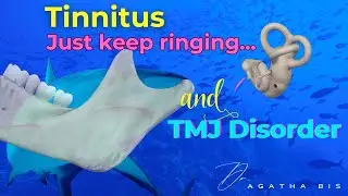 The Anterior Ligament of the Malleus: Key to Hearing and TMJ Health #dentist #tmjdisorders