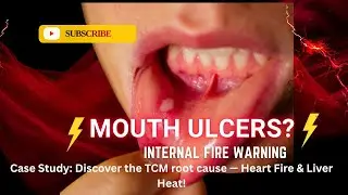 Mouth Ulcers = Internal Fire Warning!  Mouth Ulcers Case Study