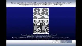 Adoptive Cell Therapy for Cancer