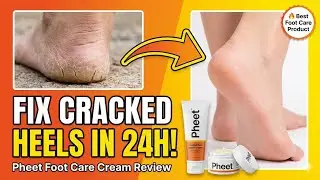 Pheet Foot Care Cream Review &ndash; Best Foot Moisturizer for Cracked Heels & Dry Feet?