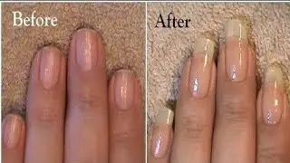 my Nail Growth Journey 👉🏼 ( Day  1 to Day 60 ) nail growth journey #nailgrowthjourney #nailgrowth 