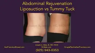 Tummy Tucks, Liposuction and Adbominal Rejuvenation