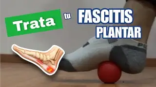 Fascitis plantar | conoce que es y trátala con estos ejercicios.
