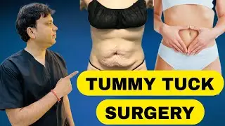 Tummy Tuck Surgery in Jaipur | Loose Skin Removal | Dr Vikas Gupta | NV Aesthetics & Dental Hub