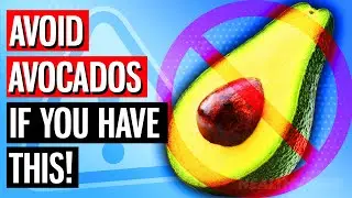 4 CRUCIAL Mistakes You Should NEVER MAKE When Eating AVOCADOS