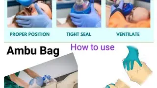 How to use Ambu Bag
