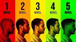 Así CONTROLÉ y VENCÍ la Calvicie Paso a Paso. Cap 1. INTRODUCCIÓN al CURSO