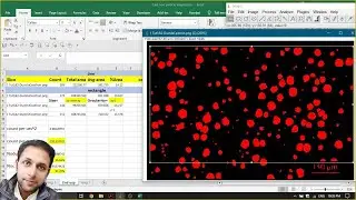 Particle count and Area Fracture study for Spheroidal Graphite (Ductile) Cast Iron