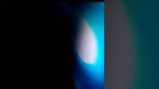 Bugzy Malone in serious bike accident