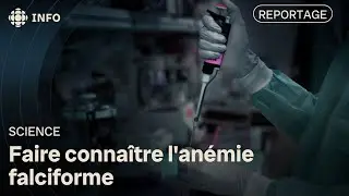 Des médecins et des patients tentent de faire connaître l'anémie falciforme