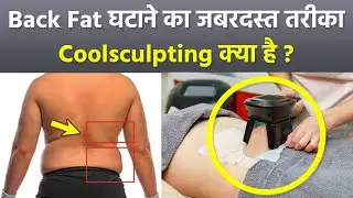 Coolsculpting Treatment For Weight Loss: Back Fat Reason and Remedy in Hindi|Boldsky