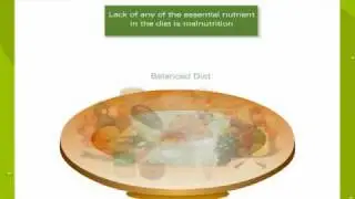 Symptoms Of Under Nutrition And Malnutrition