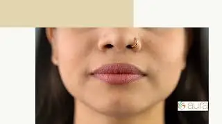 Shy When You Smile? Close the Gap with Aura&rsquo;s Complete Dental Care! | Dr. Falguni Patel