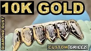 Solid 10K Gold Custom Grillz Two Tone Diamond Dust Bottom Teeth Grills