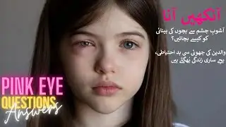 Eye Flu hone par,  Increase in Eye Infection-Conjunctivitis Outbreak by @Noorthelightpk