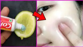 Skin Whitening Colgate Toothpaste Home Remedies/Remove darkspot, get glowing skin naturally